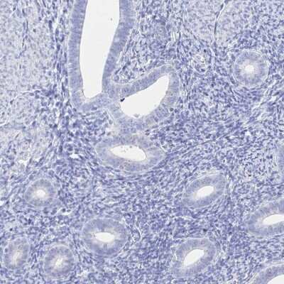 Immunohistochemistry-Paraffin: HspA4L Antibody [NBP2-49333]