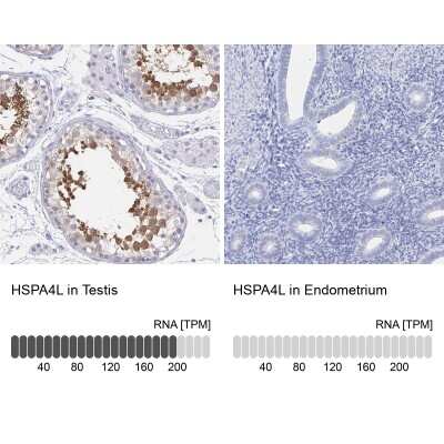 Immunohistochemistry-Paraffin: HspA4L Antibody [NBP2-49333]
