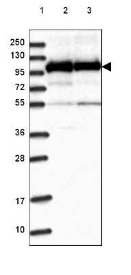 Western Blot: HspA4L Antibody [NBP2-48700]