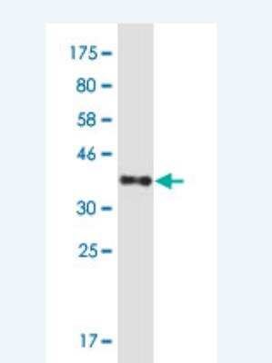 Western Blot: HspA6 Antibody (6H7) [H00003310-M01-100ug]