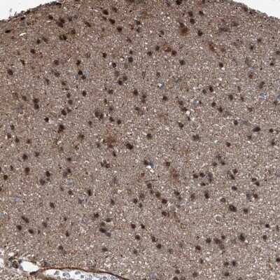 Immunohistochemistry-Paraffin: HspA6 Antibody [NBP1-85949]