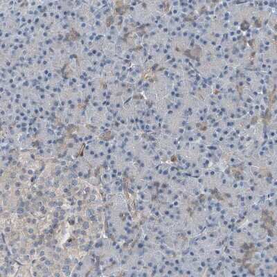 Immunohistochemistry-Paraffin: HspA6 Antibody [NBP1-85949]