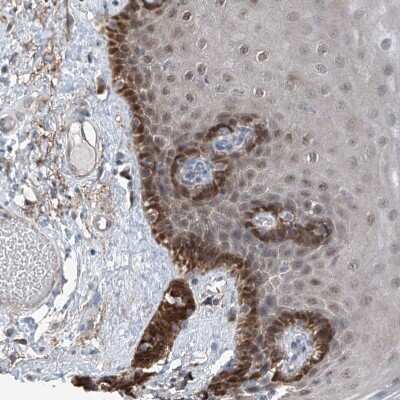 Immunohistochemistry-Paraffin: HspA6 Antibody [NBP1-85949]