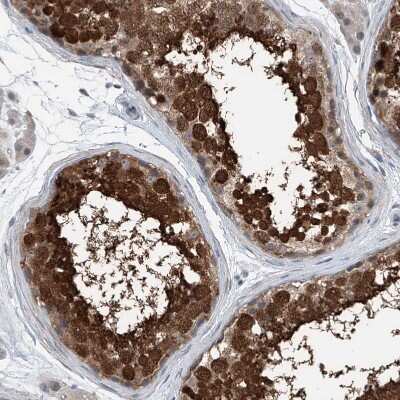 Immunohistochemistry-Paraffin: HspA6 Antibody [NBP1-85949]