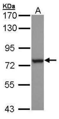 Western Blot: HspA6 Antibody [NBP1-32761]