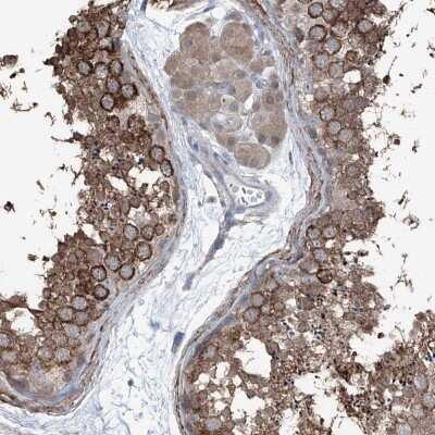 Immunohistochemistry-Paraffin: HspB11 Antibody [NBP1-88332]