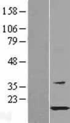 Western Blot: HspB11 Overexpression Lysate [NBL1-11758]