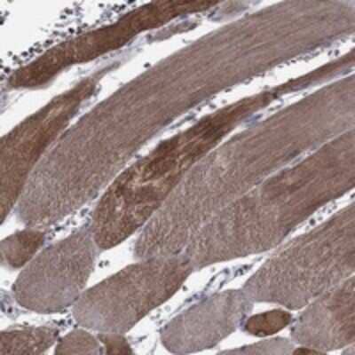 Immunohistochemistry-Paraffin: HspB2 Antibody [NBP3-17723]