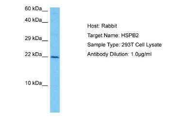 Western Blot: HspB2 Antibody [NBP2-84082]