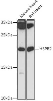 Western Blot: HspB2 AntibodyAzide and BSA Free [NBP3-04483]