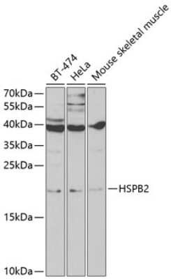 Western Blot: HspB2 AntibodyBSA Free [NBP3-04484]