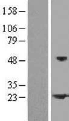 Western Blot: HspB2 Overexpression Lysate [NBP2-08193]