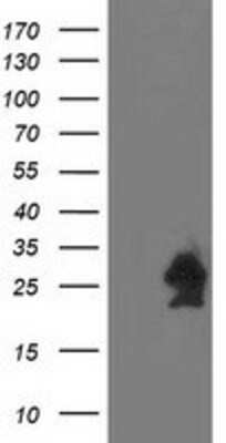 Western Blot: HspB7 Antibody (OTI1D11) [NBP2-02666]