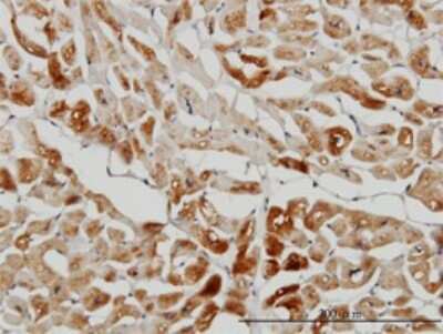 Immunohistochemistry-Paraffin: HspB7 Antibody (3E11) [H00027129-M01]