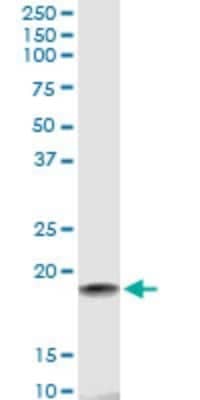 Western Blot: HspB7 Antibody (3E11) [H00027129-M01]