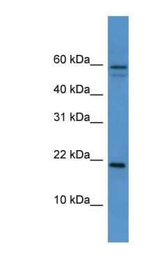 Western Blot: HspB7 Antibody [NBP1-69072]