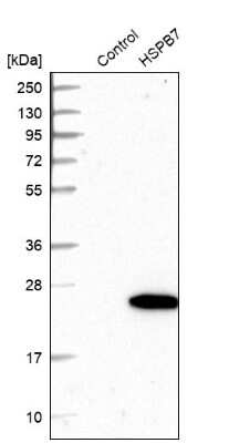 Western Blot: HspB7 Antibody [NBP1-84334]