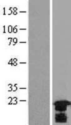 Western Blot: HspB7 Overexpression Lysate [NBL1-11760]