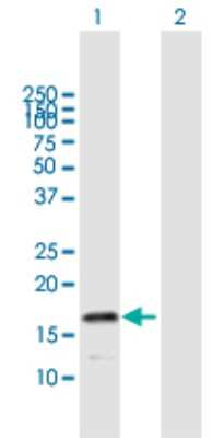 Western Blot: HspB9 Antibody [H00094086-B01P]