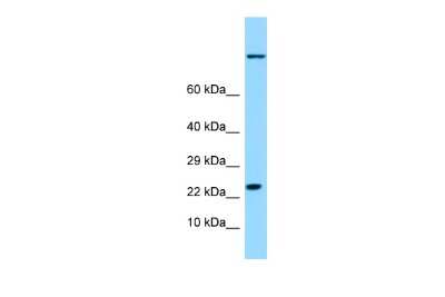 Western Blot: HspB9 Antibody [NBP2-84083]