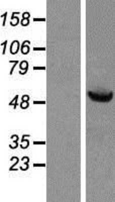 Western Blot: HspBAP1 Overexpression Lysate [NBP2-06313]