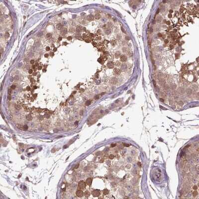 Immunohistochemistry: HspBP1 Antibody [NBP2-49658]