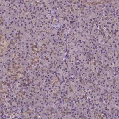 Immunohistochemistry-Paraffin: HspBP1 Antibody [NBP2-49658]