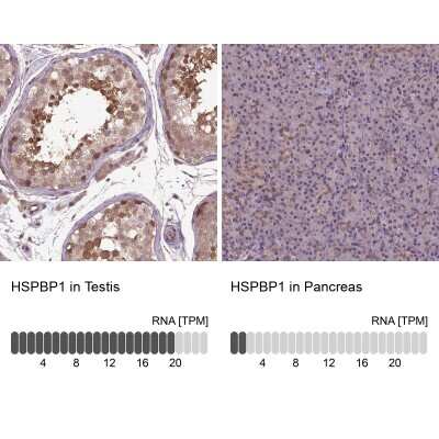 Immunohistochemistry-Paraffin: HspBP1 Antibody [NBP2-49658]