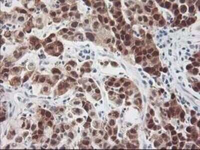 Immunohistochemistry: HspBP1 Antibody (OTI1D5) - Azide and BSA Free [NBP2-71761]