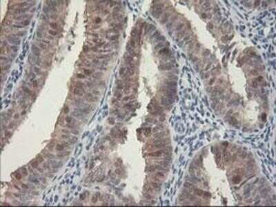 Immunohistochemistry-Paraffin: HspBP1 Antibody (OTI1D5) [NBP2-01168]