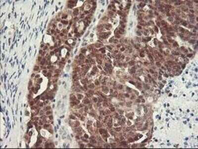 Immunohistochemistry-Paraffin: HspBP1 Antibody (OTI1D5) [NBP2-01168]
