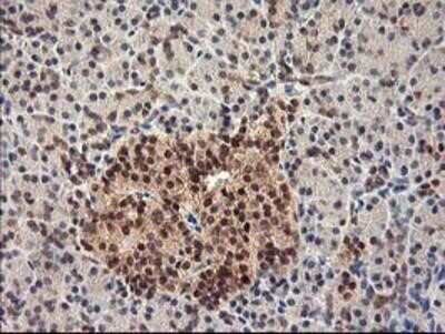 Immunohistochemistry-Paraffin: HspBP1 Antibody (OTI1D5) [NBP2-01168]