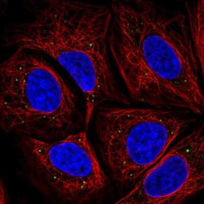 Immunocytochemistry/ Immunofluorescence: HtrA3 Antibody [NBP2-56875]