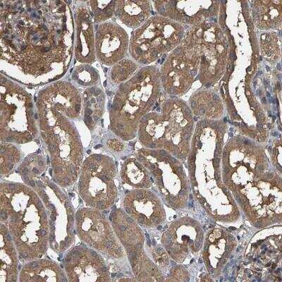 Immunohistochemistry-Paraffin: HtrA3 Antibody [NBP1-87211]