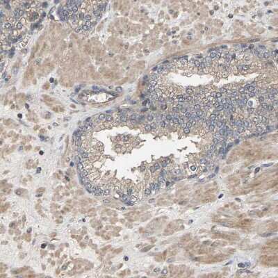 Immunohistochemistry-Paraffin: HtrA3 Antibody [NBP1-87211]
