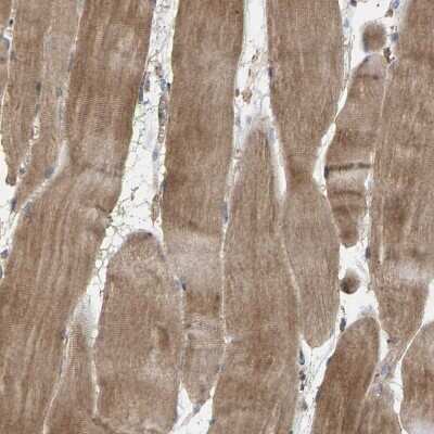 Immunohistochemistry-Paraffin: HtrA3 Antibody [NBP1-87211]