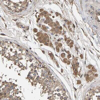 Immunohistochemistry-Paraffin: HtrA3 Antibody [NBP1-87211]