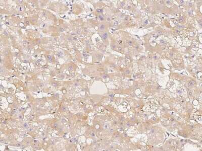 Immunohistochemistry-Paraffin: HtrA3 Antibody [NBP2-99121]