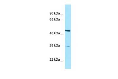 Western Blot: HtrA3 Antibody [NBP2-87609]