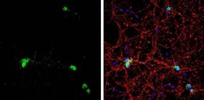 Immunocytochemistry/ Immunofluorescence: HuC Antibody [NBP3-13367]