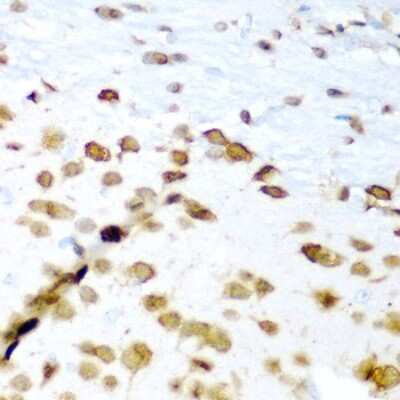 Immunohistochemistry-Paraffin: HuC Antibody - Azide and BSA Free [NBP3-02943]