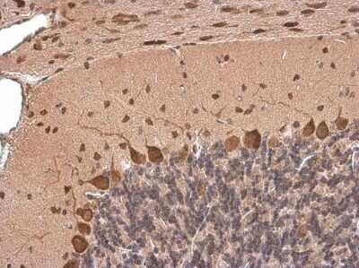 Immunohistochemistry-Paraffin: HuC Antibody [NBP3-13367]