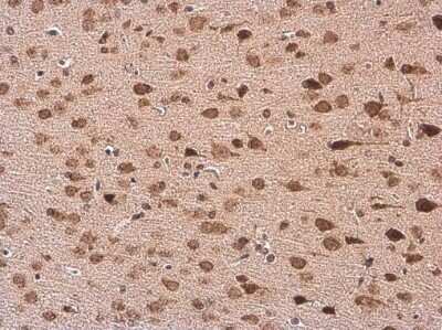 Immunohistochemistry-Paraffin: HuC Antibody [NBP3-13367]