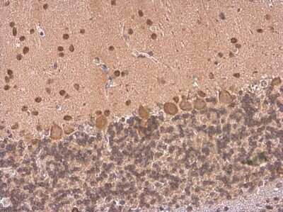 Immunohistochemistry-Paraffin: HuC Antibody [NBP3-13367]