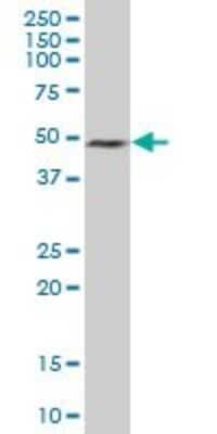 Western Blot: HuC Antibody [H00001995-B01P]