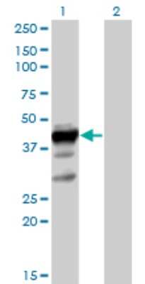 Western Blot: HuC Antibody [H00001995-B01P]