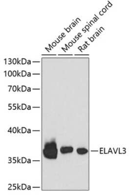 Western Blot: HuC AntibodyAzide and BSA Free [NBP3-02943]