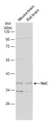 Western Blot: HuC Antibody [NBP3-13367]