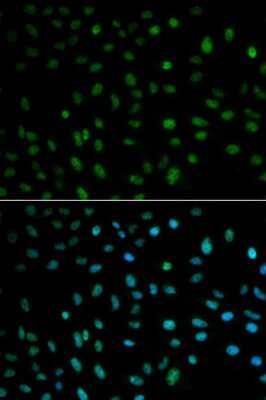 Immunocytochemistry/ Immunofluorescence: HuR/ELAVL1 Antibody - BSA Free [NBP3-03449]