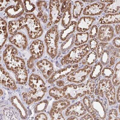 Immunohistochemistry: HuR/ELAVL1 Antibody [NBP2-38548]